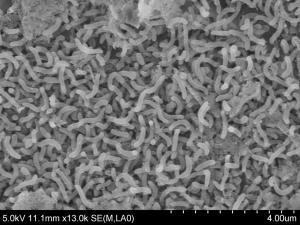 Electron micrograph of SAR11 strain HIMB4 cultured from Kaneohe Bay, Hawaii.  Courtesy Michael Rappe