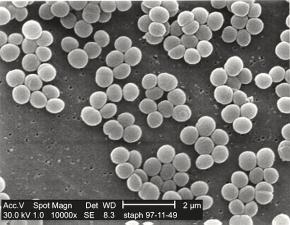 <p><strong>Fig. 1.2.</strong> (<strong>D</strong>) The bacterium <em>Staphylococcus aureus</em> is invisible to the humans without the aid of a powerful scanning electron microscope.</p>
