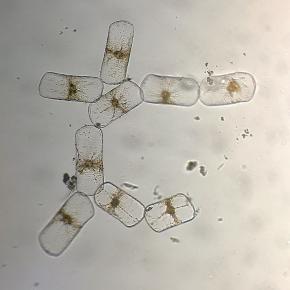 <p><strong>Fig. 2.34.</strong>&nbsp;(<strong>B</strong>) Colonial diatoms</p>
