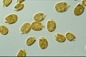 <p><strong>Fig. 2.35.</strong>&nbsp;(<strong>D</strong>) Light microscope image of dinoflagellates</p>
