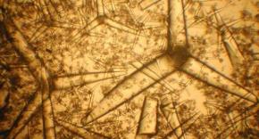 <p><strong>Fig. 3.21.</strong>&nbsp;(<strong>B</strong>) Microscopic spicule lattice from Pachastrellid sponge</p>
