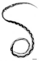 <p><strong>Fig. 3.41.</strong>&nbsp;(<strong>E</strong>) Rat lungworm (<em>Angiostrongylus cantonensis</em>), a nematode parasite that can cause meningitis</p>
